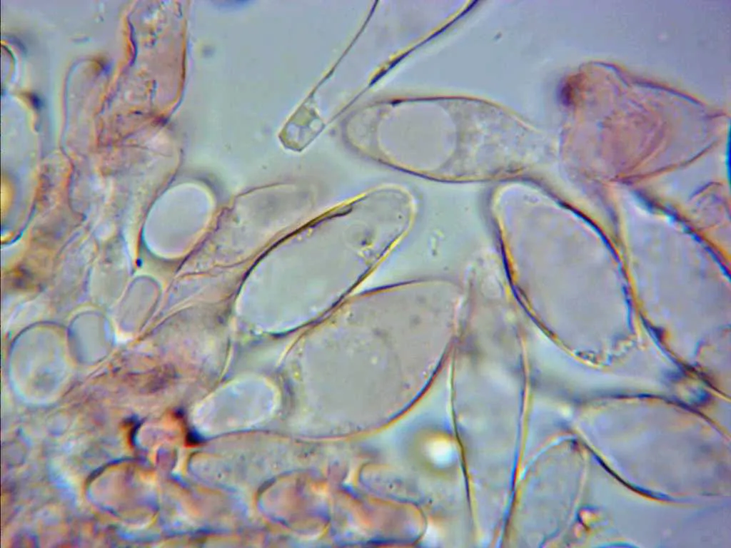 Microscopía de Pluteus nanus - 10 - Queilocistidios 2